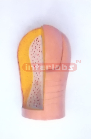 ENLARGED & ANATOMICAL FOOTNAIL MODEL